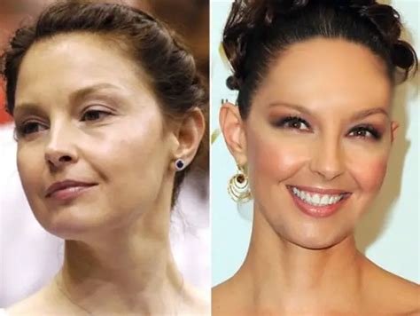 ashley judd face lift|The Truth About Ashley Judds Plastic Surgery Rumors